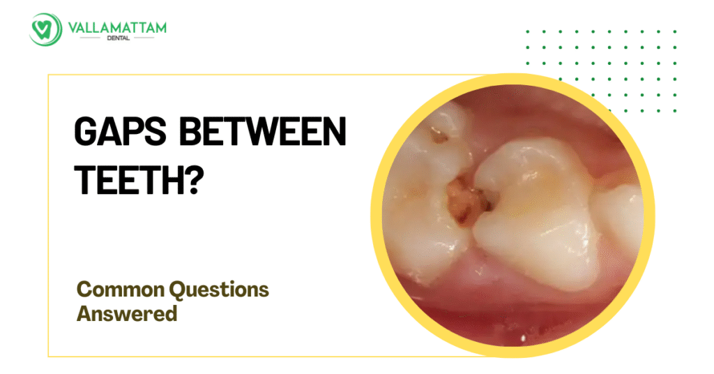 Diastema or Gaps Between Teeth Common Questions Answered Patients teeth with gap between molars