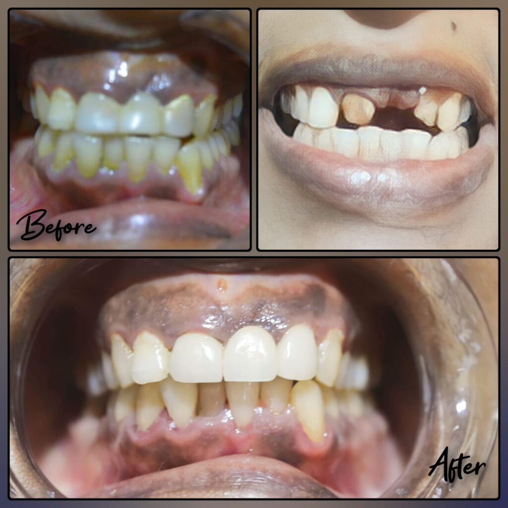 General Dentistry Before & after image of a patient