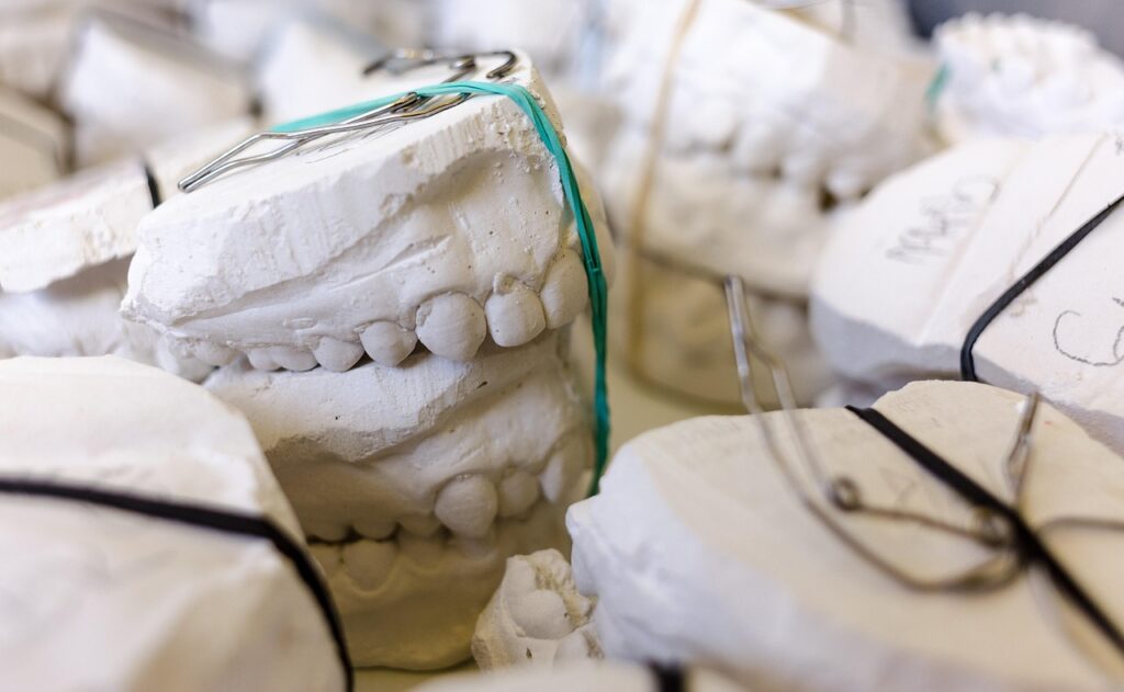 teeth, models, gypsum, dentist, dental, dentistry, dentist, dentist, dental, dental, dental, dental, dental