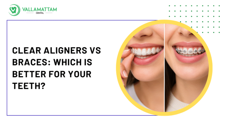 Clear Aligners vs Braces: Which Is Better for Your Teeth?