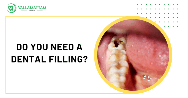 Do you need A dental filling