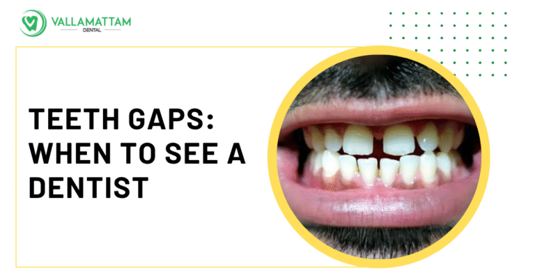 Close-up of a smile showing a prominent gap between the upper front teeth