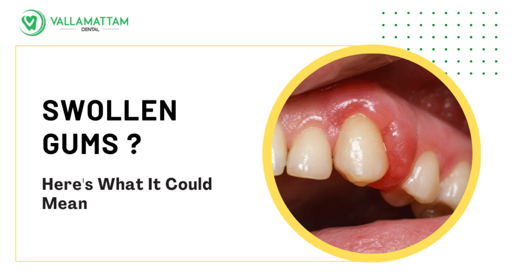Swollen Gums Around One Tooth? Here’s What It Could Mean